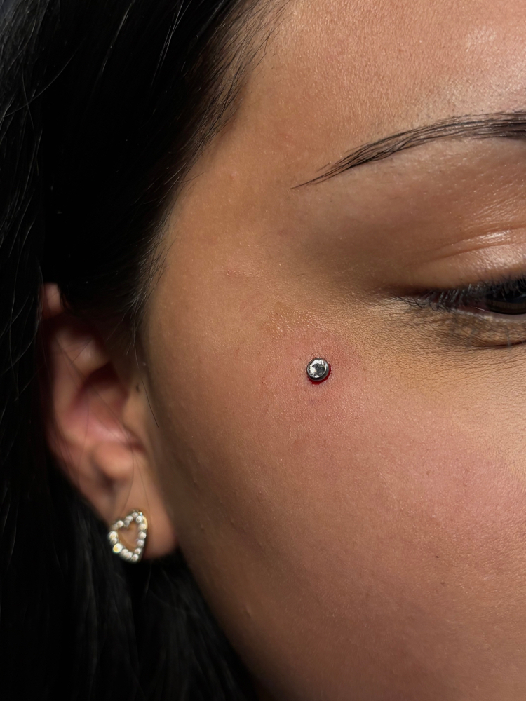 Dermal Removal at PunkturedByKal in Arlington, TX