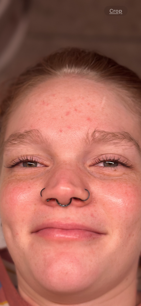 Lash Lift