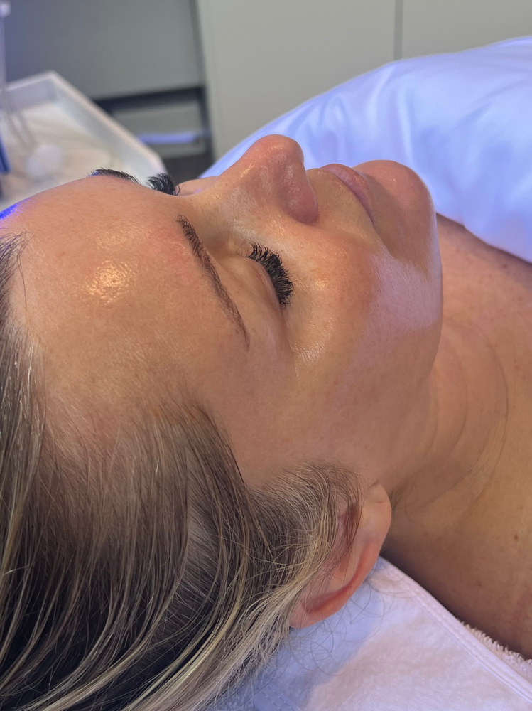 Custom Signature Hydrafacial