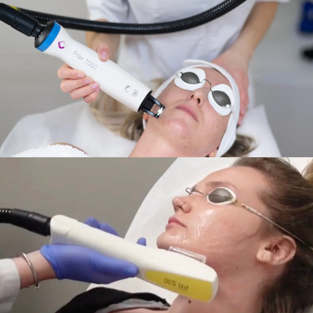 NORDLYS 2 In 1 FRAX - IPL PACKAGE