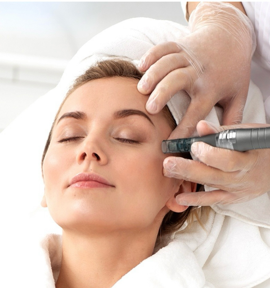 PRP Microneedling at Happy Feet & Aesthetics in Plainview, TX