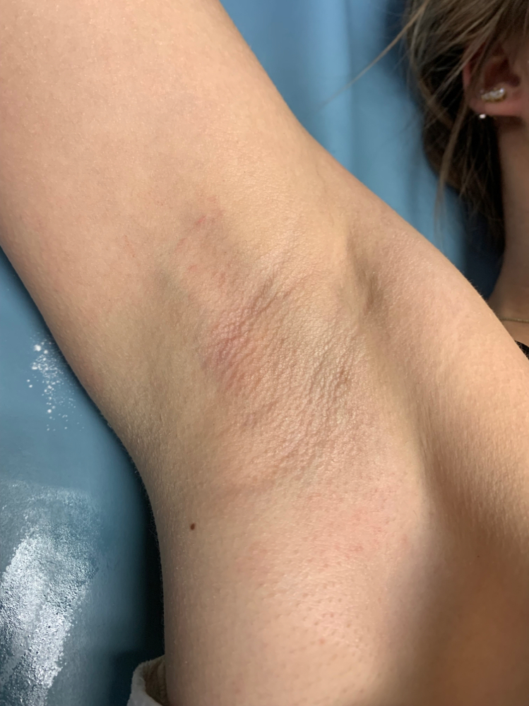 Underarm Wax