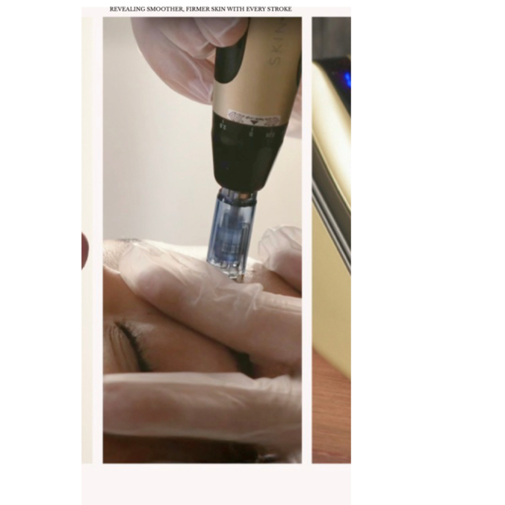 Nano Infusion Facial Treatment at Esthetics Amor LLC in Wellington, FL