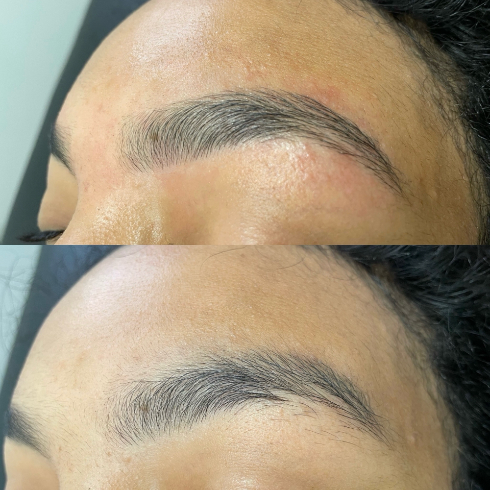 Brow