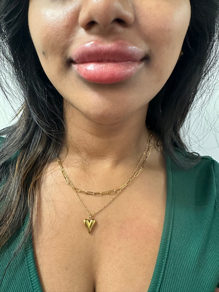 Facial Balancing at Skin2Skin