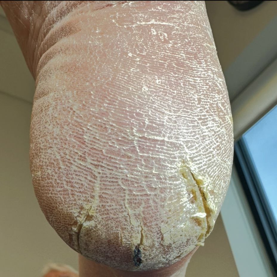 Advanced Pedicure + KART