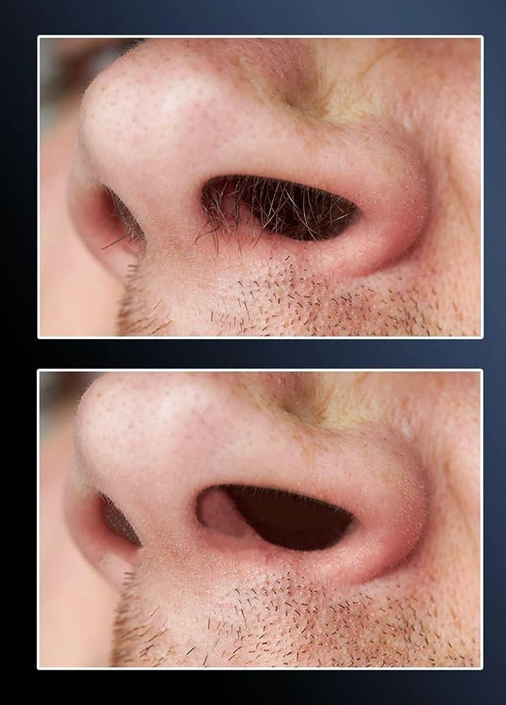 Nose Wax