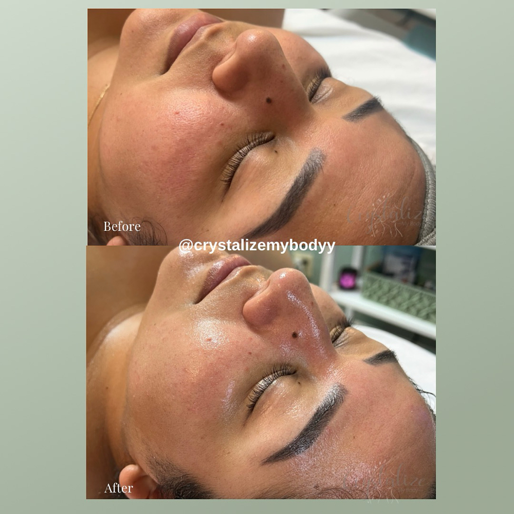 Hydrating Facial