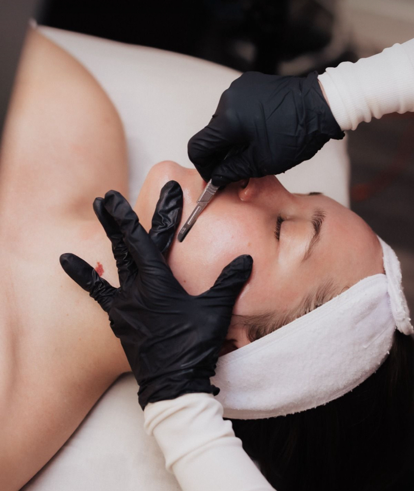 Dermaplane Facial