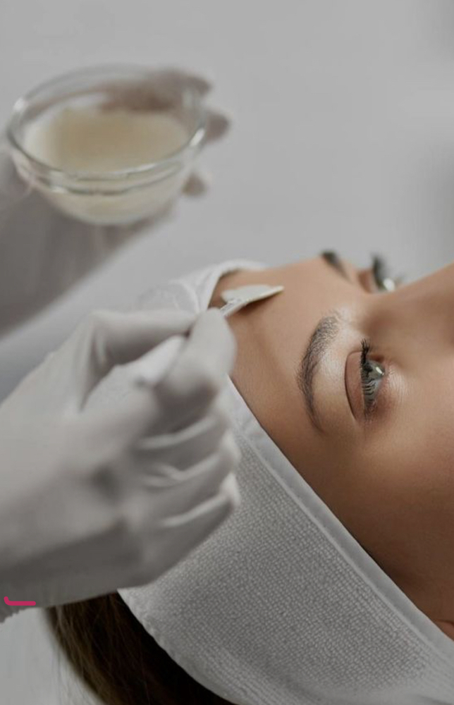Chemical Peel add-on