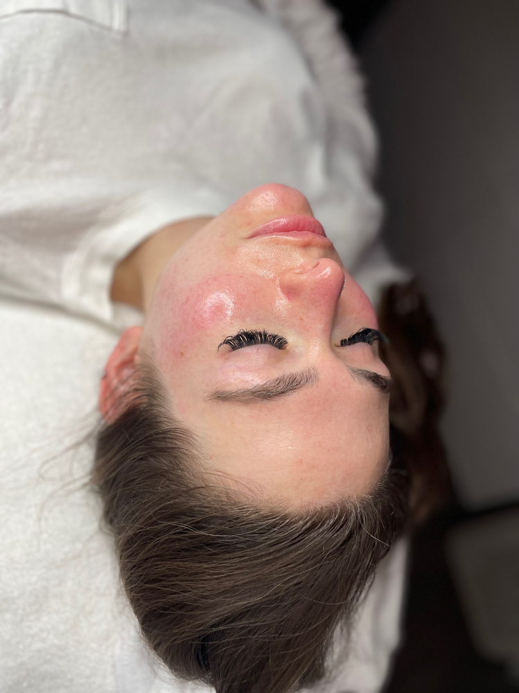 Dermaplaning Glow Facial