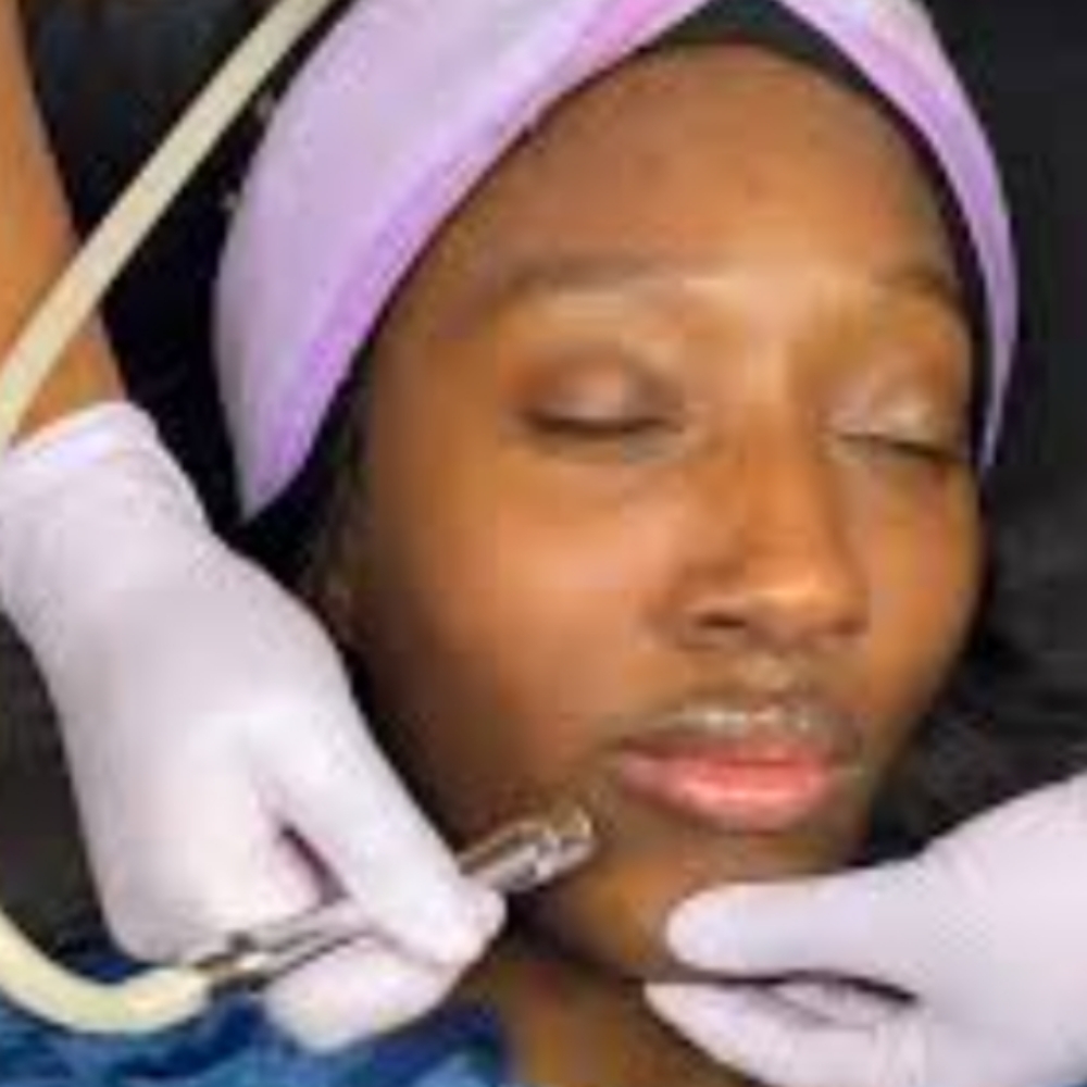 Microdermabrasion Facial at Blissfull Massage and Esthetics in Lafayette, CO