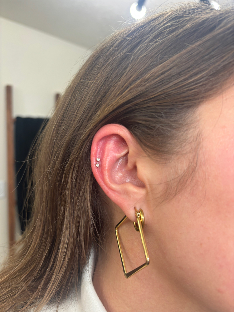 Double helix