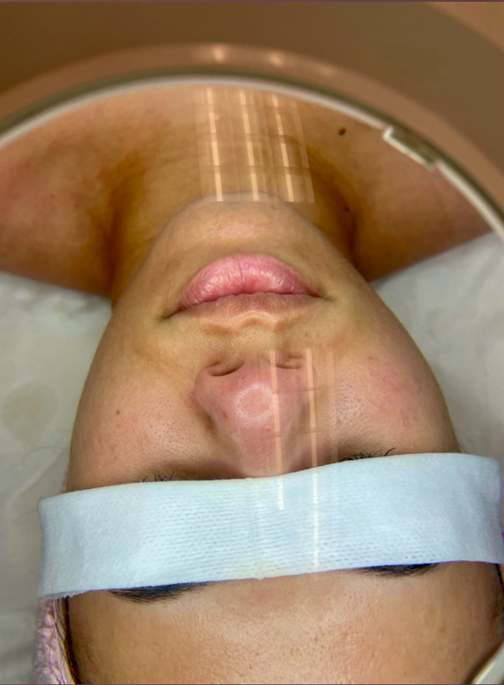 New Client Facial