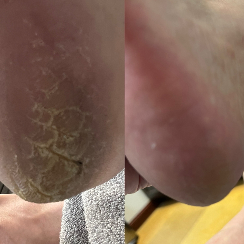 sa’SHá Stand Alone Heel Treatment at Marnicured Nail Salon in Plymouth, MN