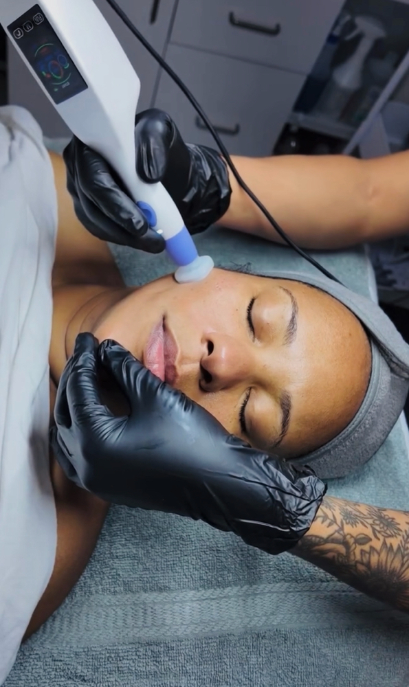 Jet Plasma Treatment