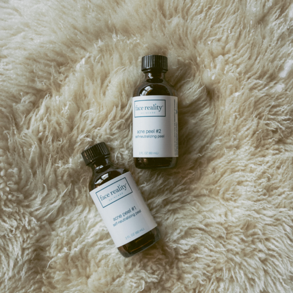 Chemical Peel at Moon Face Aesthetics in Dayton, OH