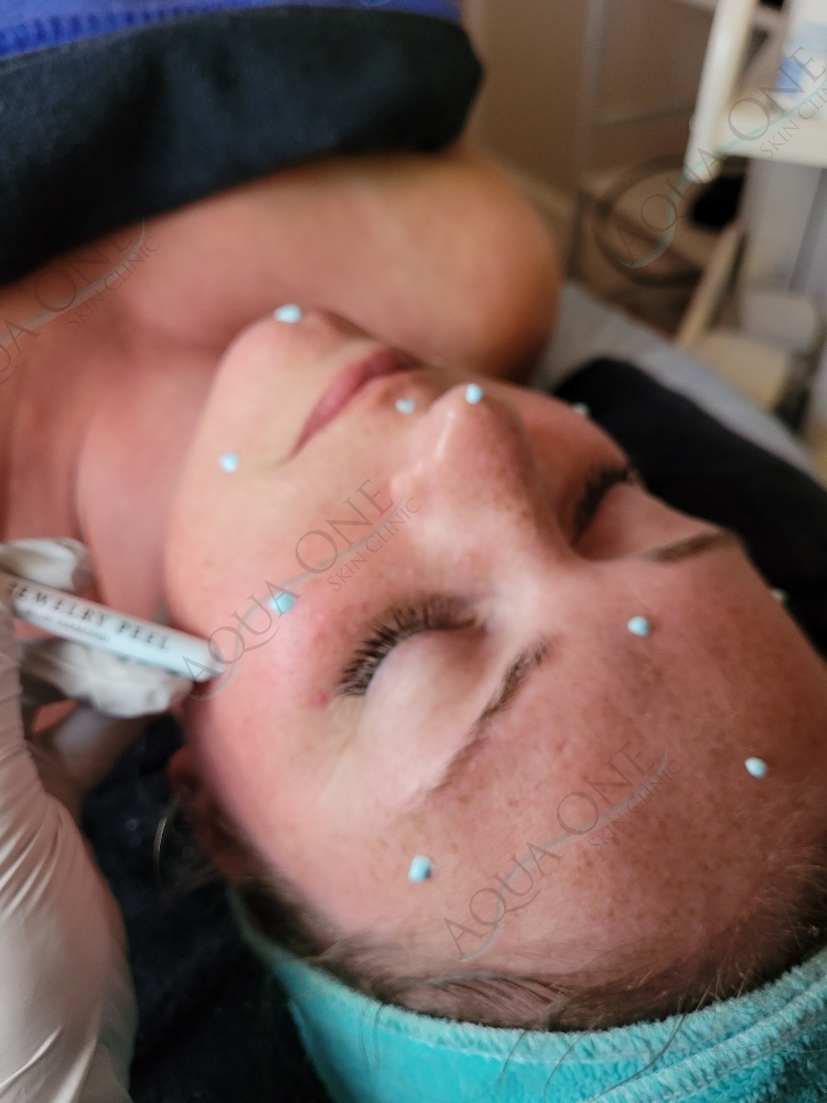 Facial- Jewelry Treatment