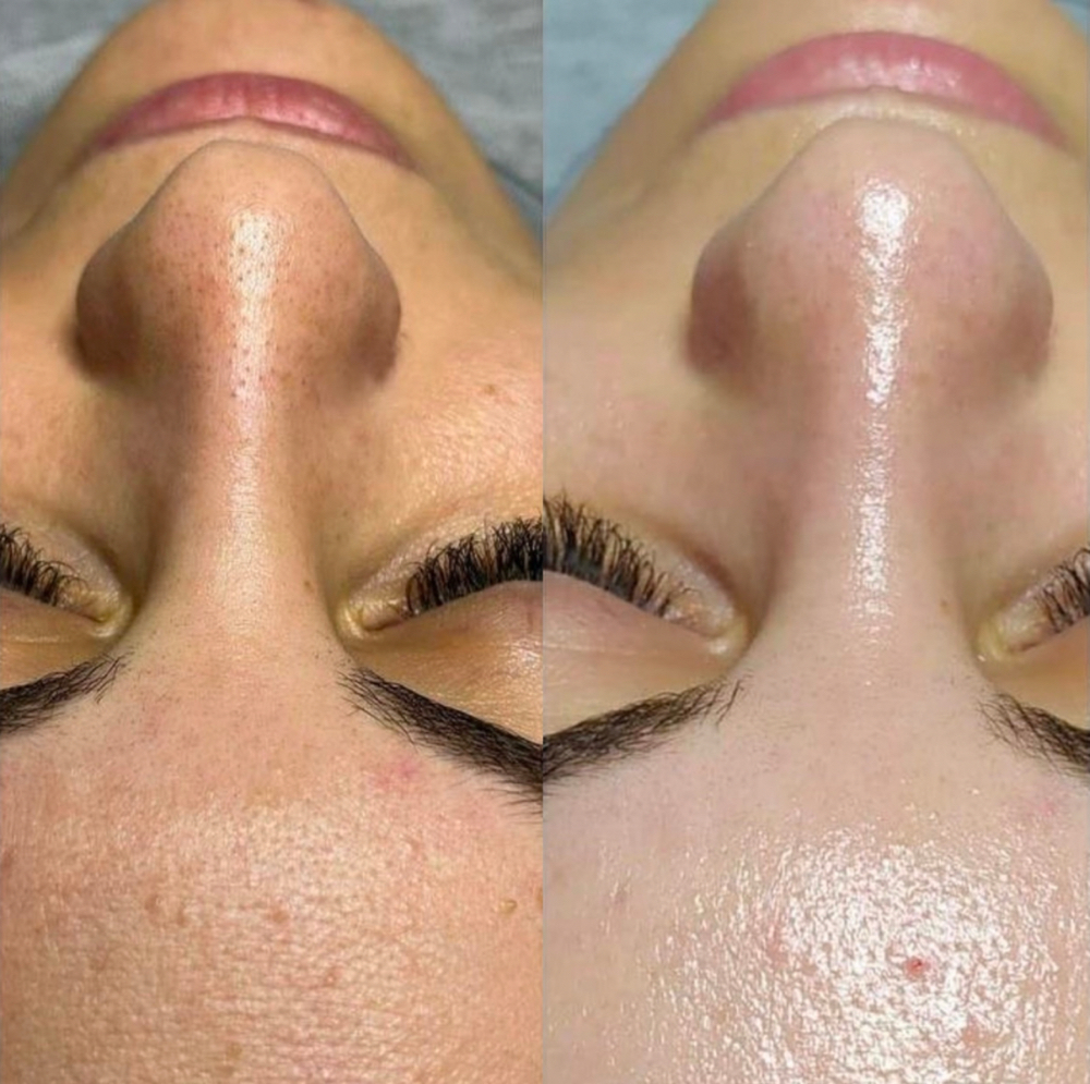 SIGNATURE CUSTOM FACIAL