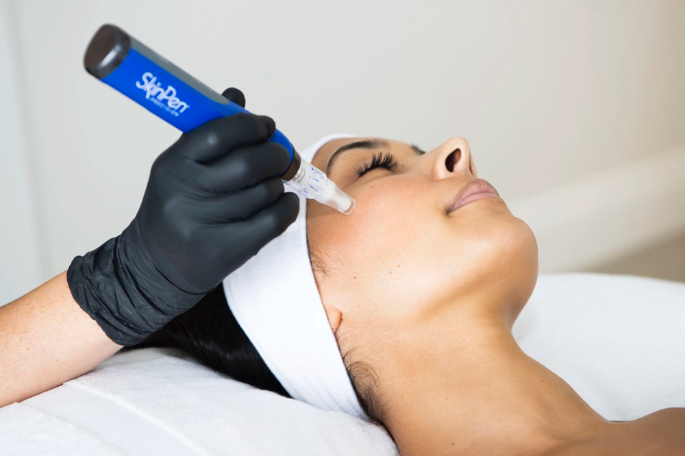 SkinPen Microneedling