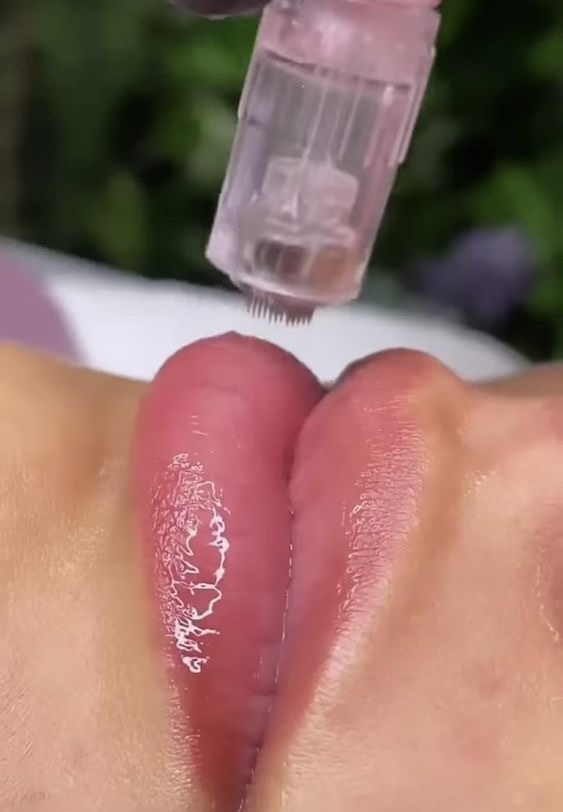 Hydra Lips Gloss at Zoraya Velez AESTHETICIAN in Richmond, VA