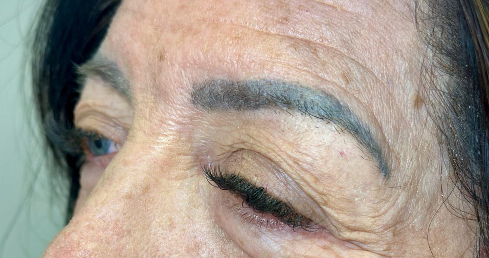 Permanent Make Up Removal