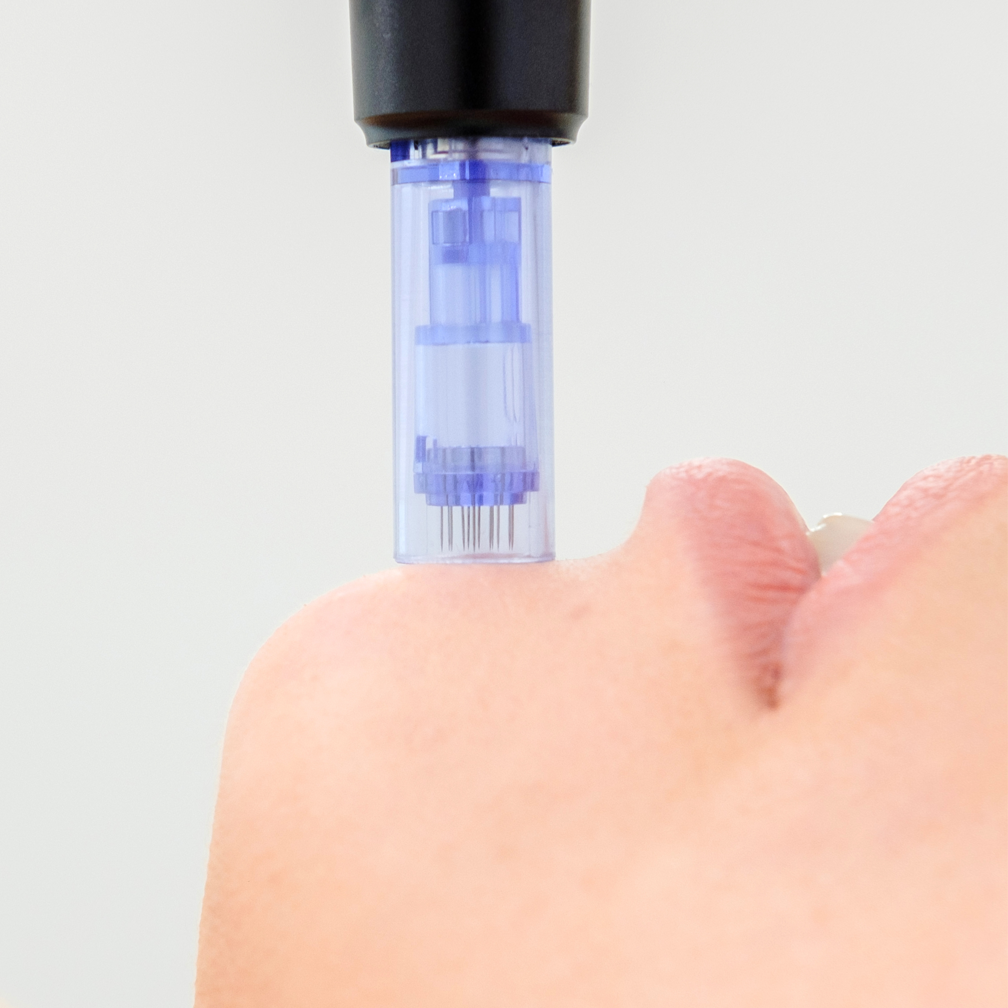 Microneedling at AZ Brows & Skin in Scottsdale, AZ