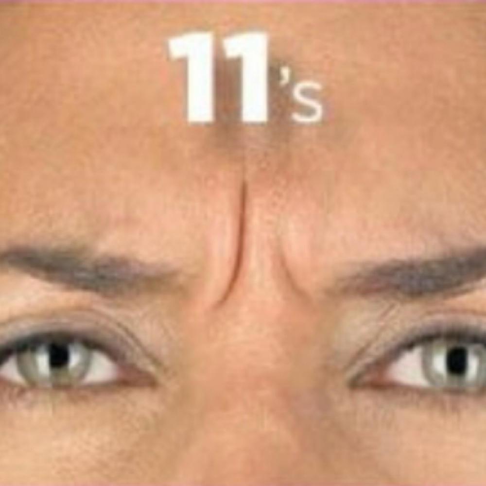 11’s Botox at Glow Studio in San Antonio, TX