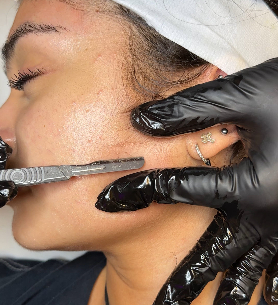 Dermaplaining Facial