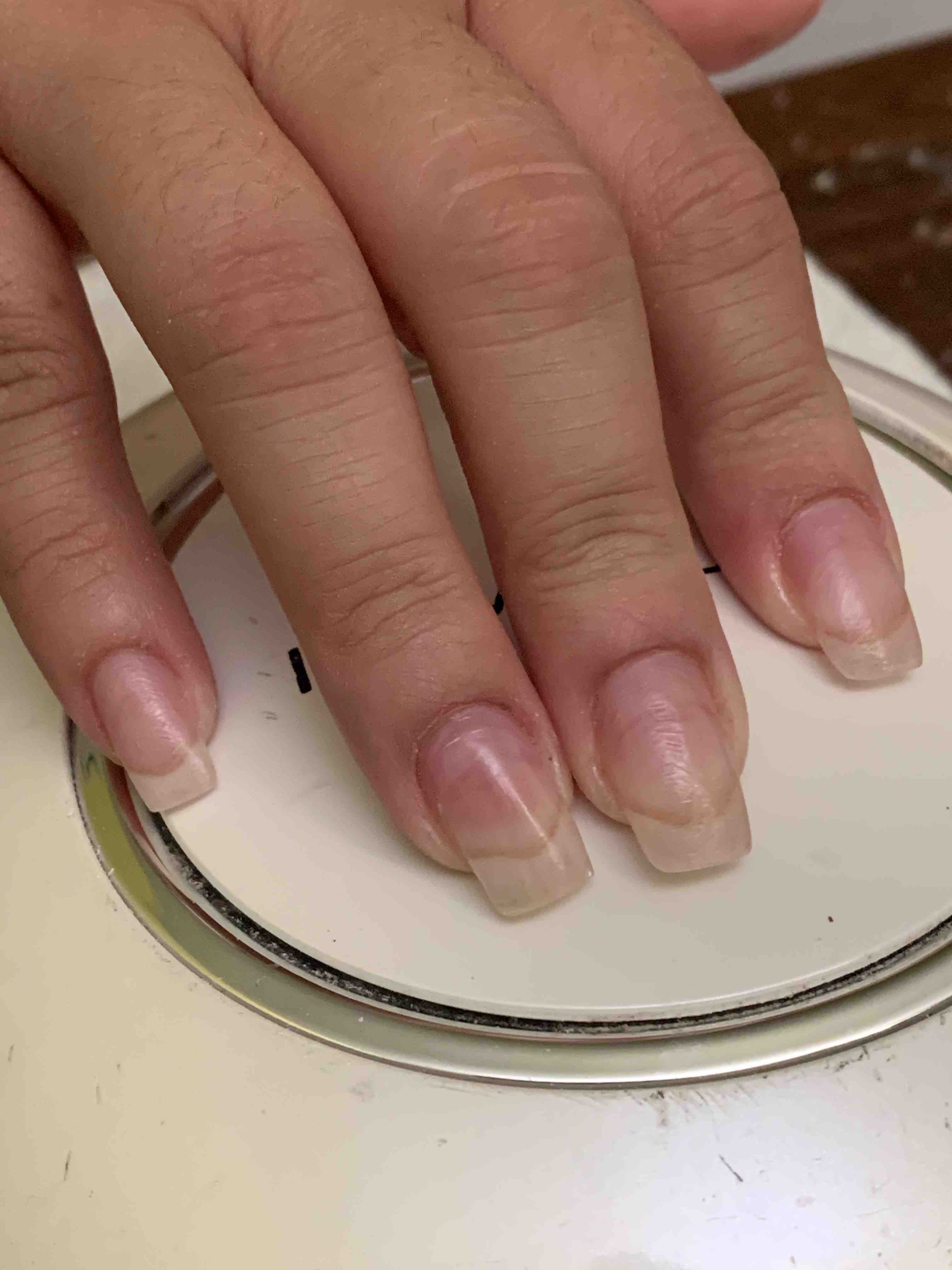 Artificial Nail Removal