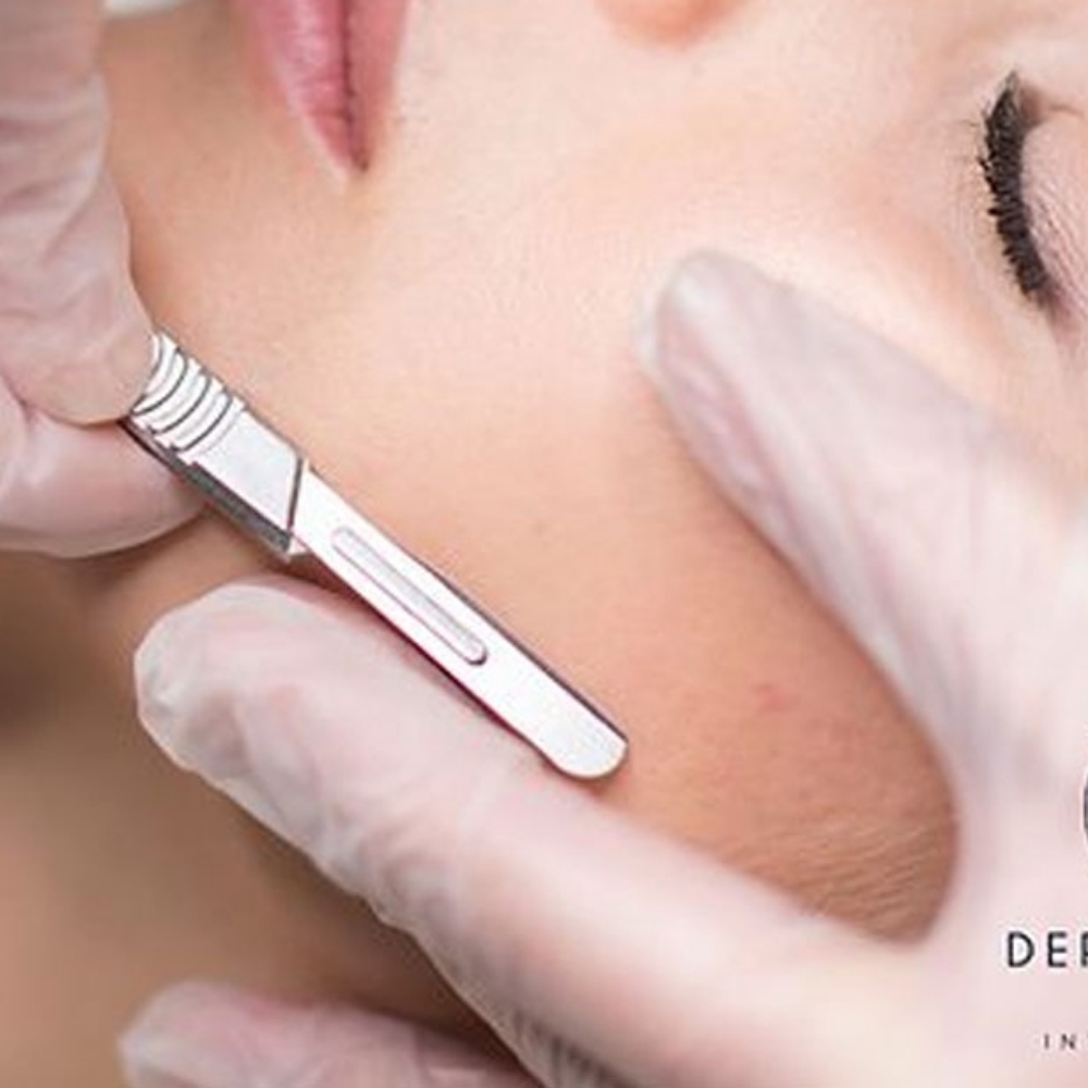 Add On Dermaplane at chanda skin care in Albuquerque, NM