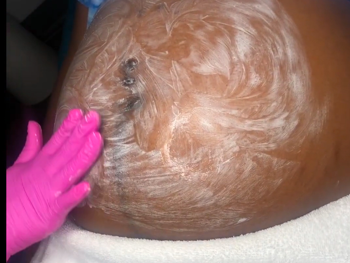 Maternity Belly Facial