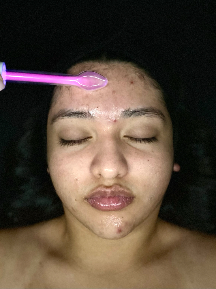 Acne & Deep Pore Facial