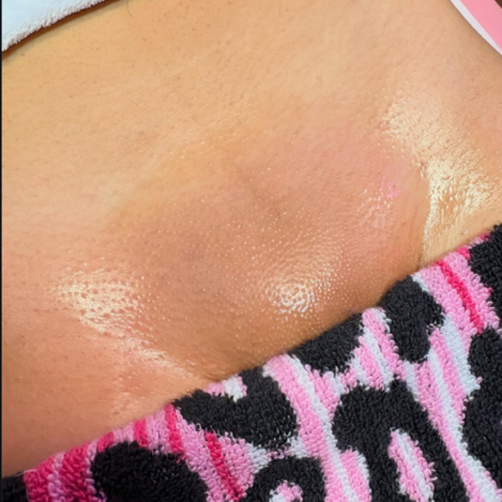 Brazilian at SkinByErica in Weslaco, TX