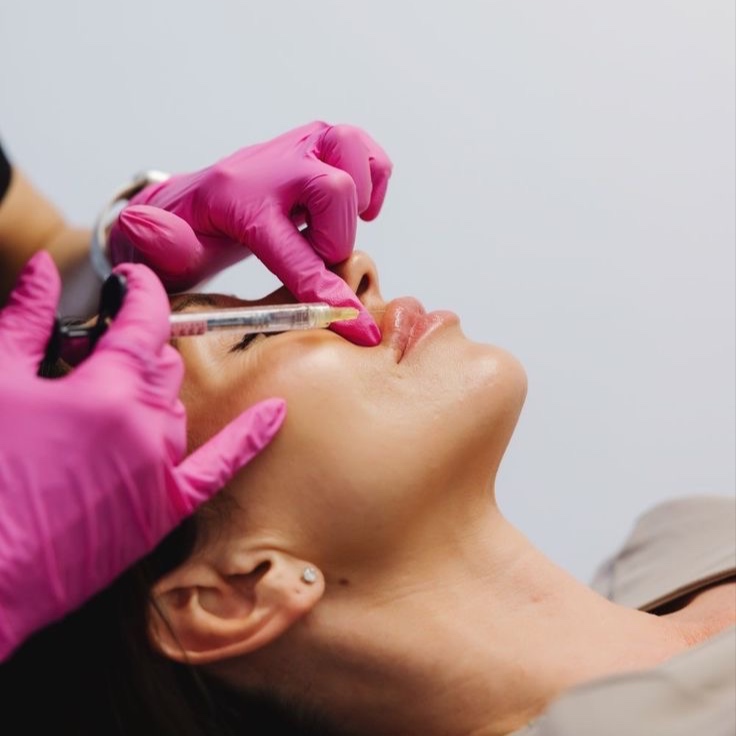 1/2 Syringe of Filler at Luxe Beauty Bar & IV Hydration in Idabel, OK