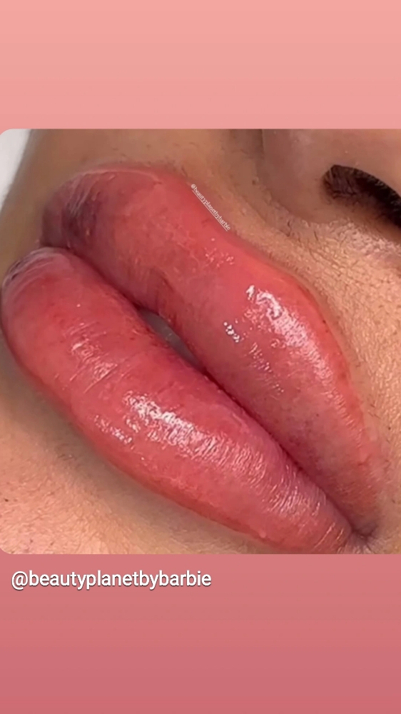 Lips 12-24 Month Touch Up