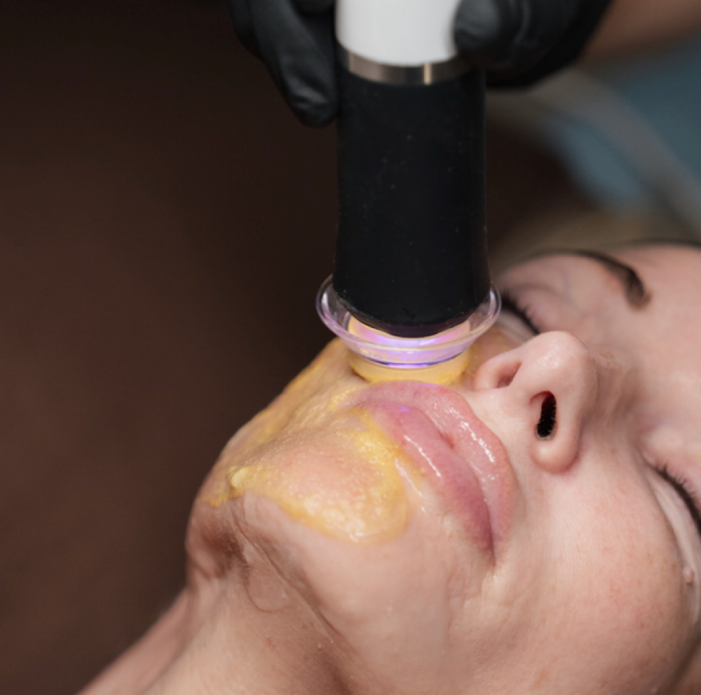 Glo₂Facial at Mii Korean Aesthetics in Lexington, KY