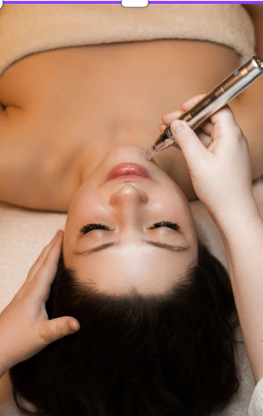MICRONEEDLING FACIAL at Yampa Glow Aesthetics in STEAMBOAT SPR, CO