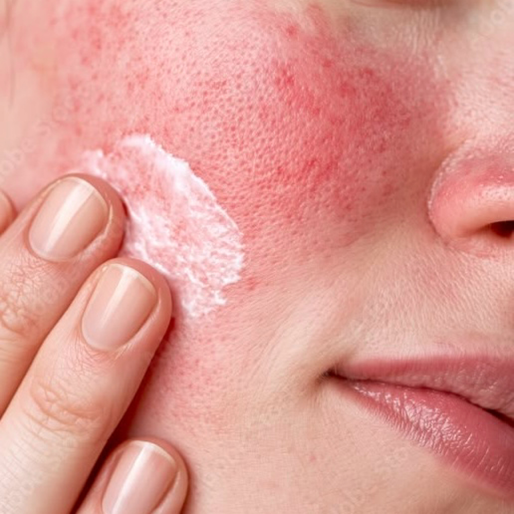 Soothing Facial For Sensitive Skin at Golden’s Skin and Ink in Cape Coral, FL