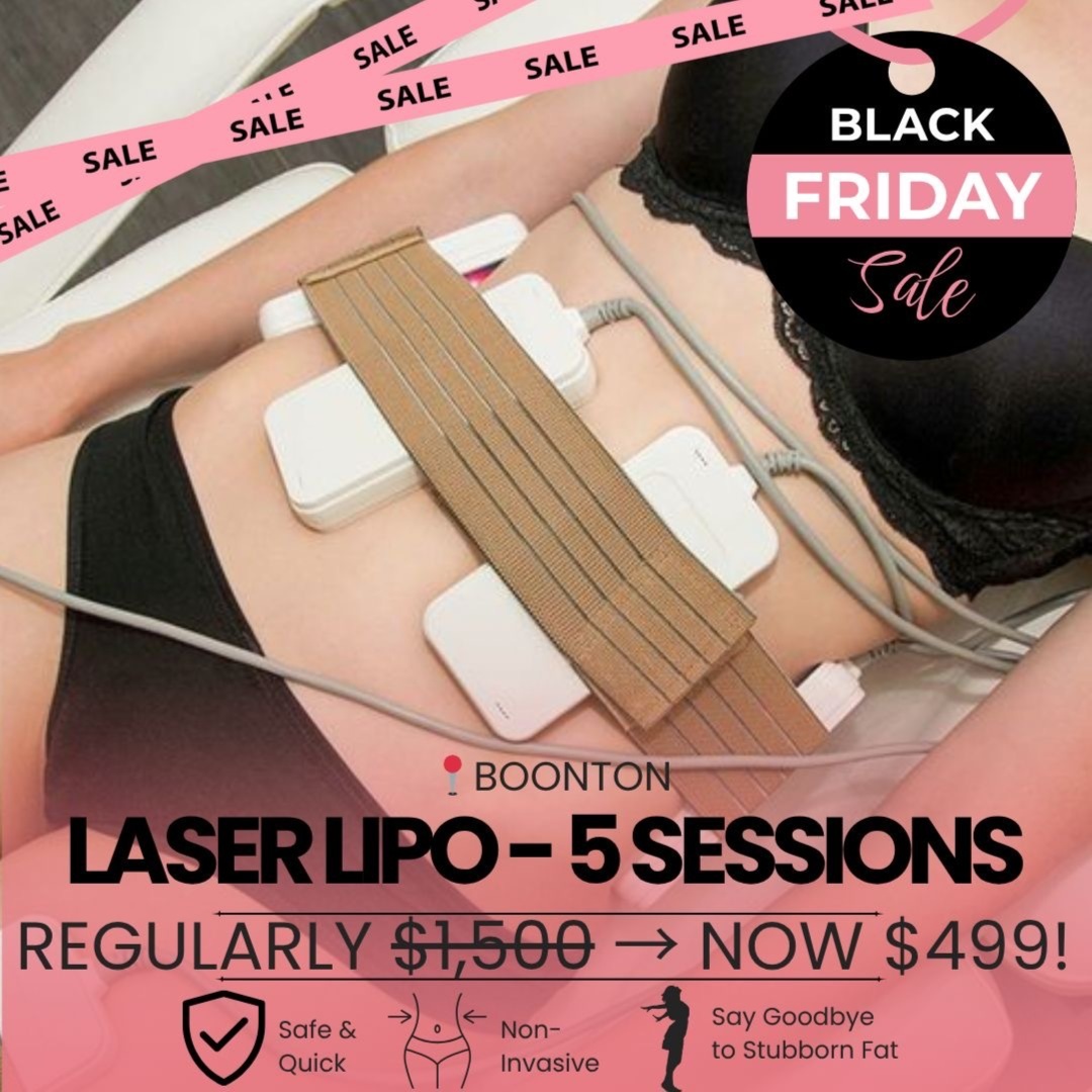 Lipo Package 5 Sessions for $499