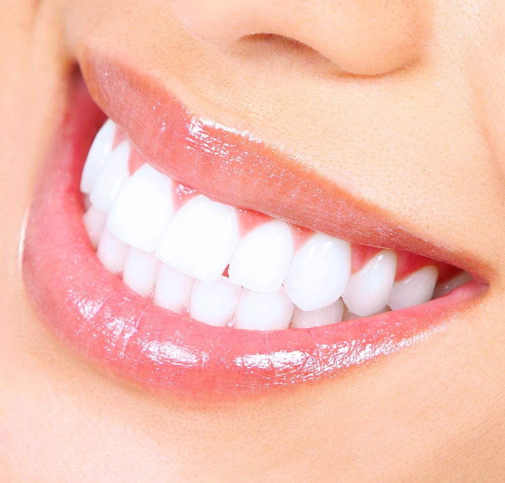 Teeth Whitening 20 Minutes