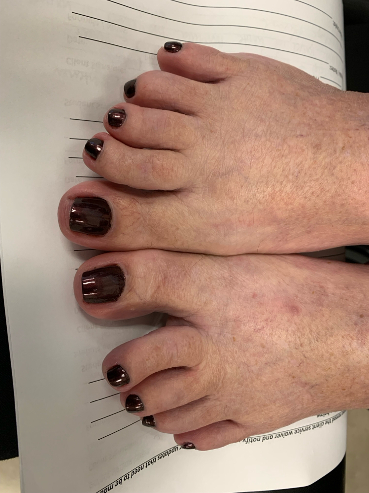 Pedicure
