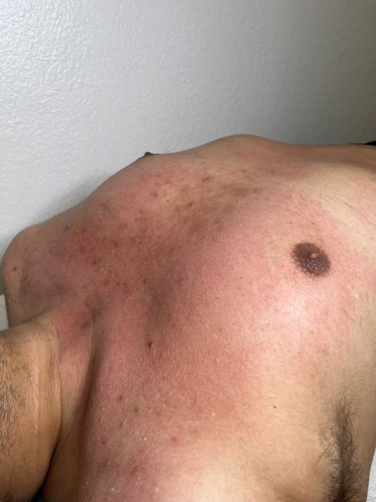 Chest Wax