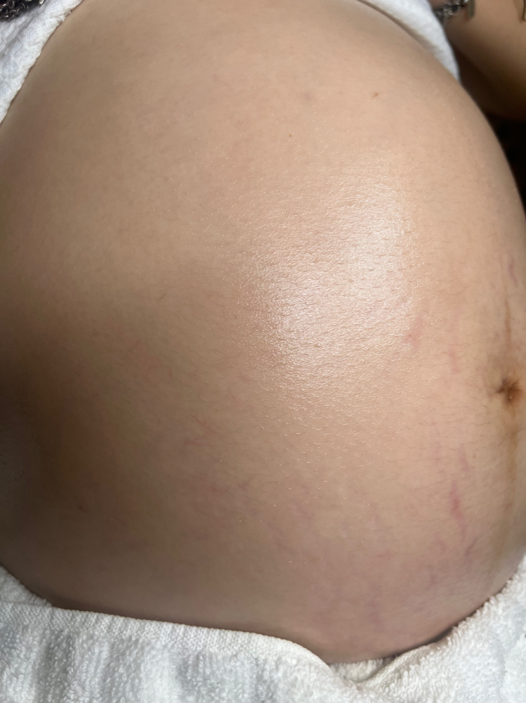 The Baby Bump Glo