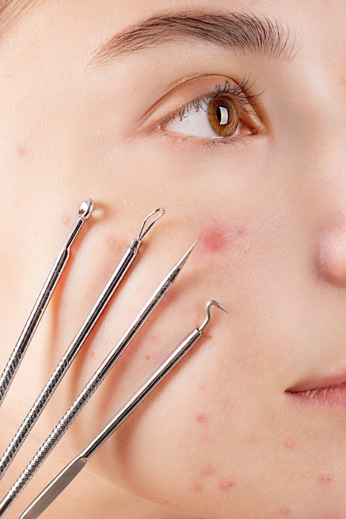 Extractions