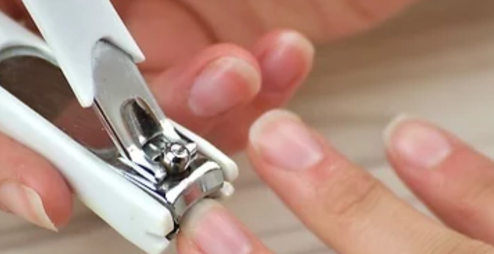 Finger Nail Trim
