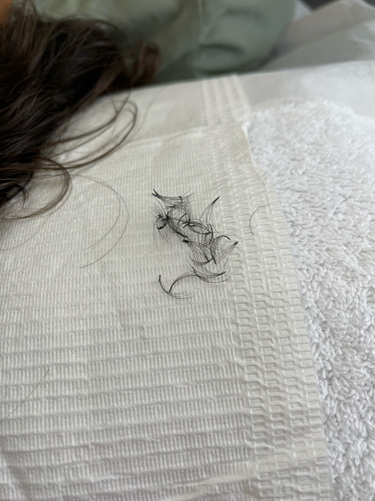 Lash Removal