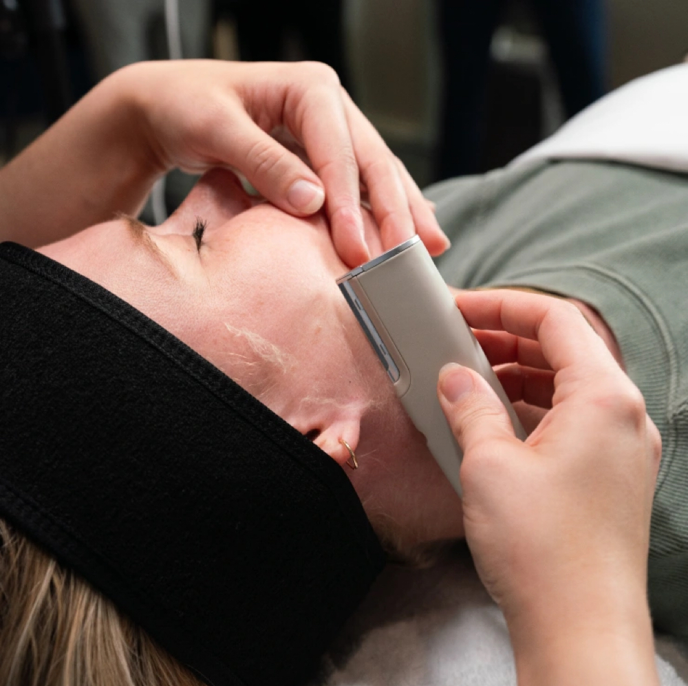 Sonic Dermaplaning Therapy at Esthetics By Cindy in Naples, FL
