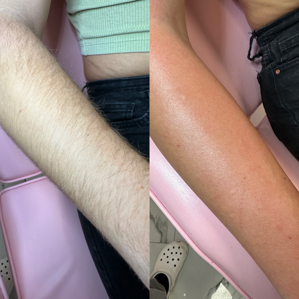 Half Arm