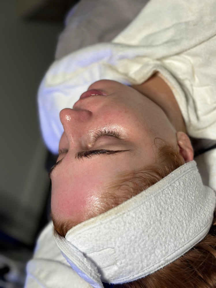 Dermaplaning Facial